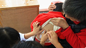 中国传统医学中最具特色的伏天保健疗法—三伏天灸