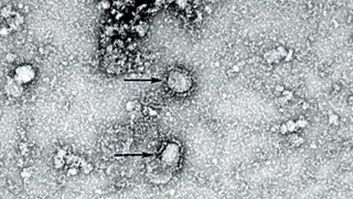海关总署：全国海关检出境外新冠肺炎输入病例75例