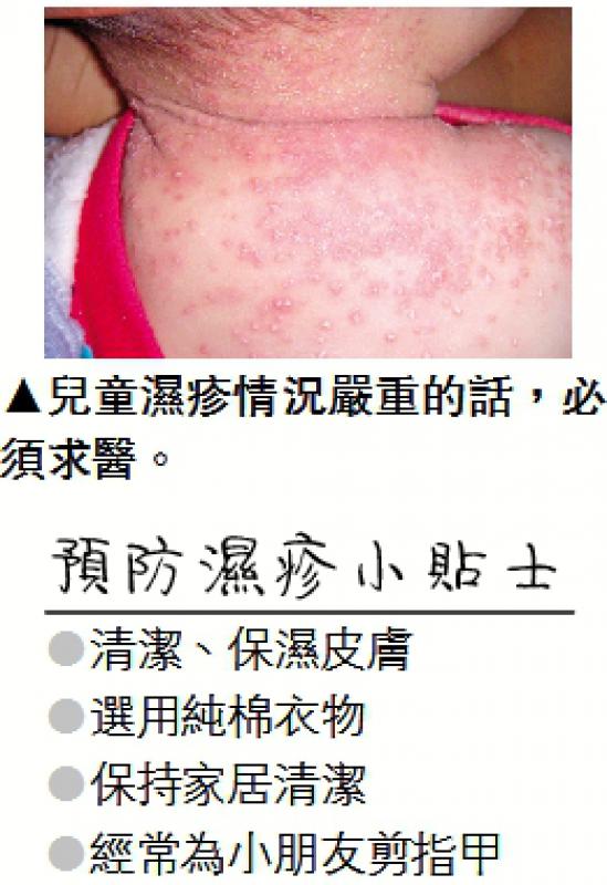 ﻿健康资讯/儿童湿疹好发於转季之时
