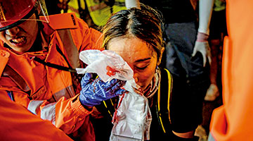 被拍现身机场赴台湾 爆眼女谎言爆破双眼炯炯有神