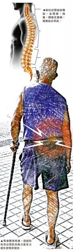 ﻿骨骼退化/长者腰背痛致坐骨神经受损