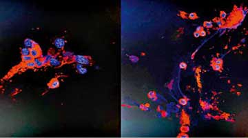 港大成功分离Omicron病毒株 助开发疫苗