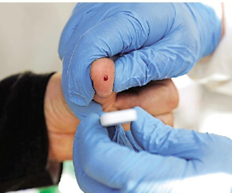 ﻿杏林细语/减低感染爱滋病病毒风险