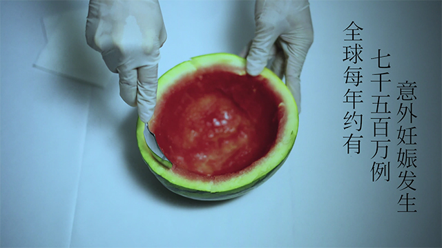 三等奖《这是一场孕动》