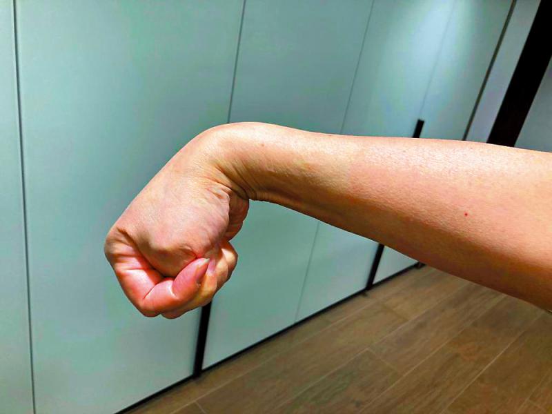 ﻿简易运动 纾缓“妈妈手”