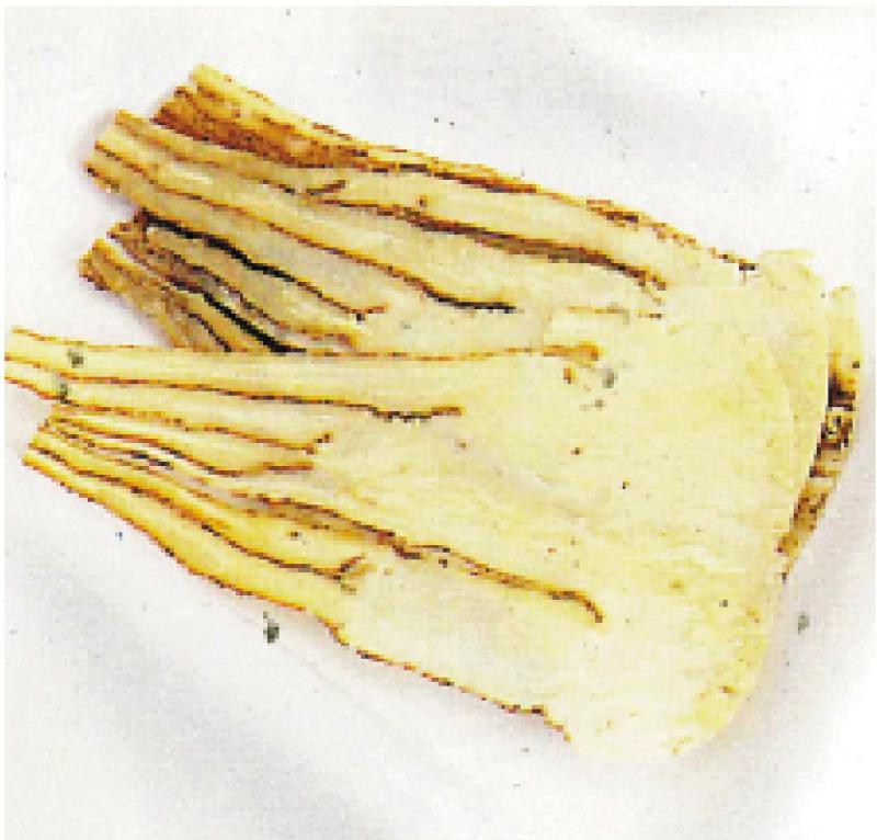 ﻿药食同源/当归补血活血
