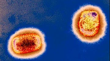 中国大陆首例输入性病例猴痘毒株成功分离