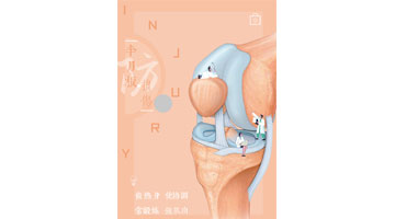 优秀制作水平奖《预防半月板损伤》