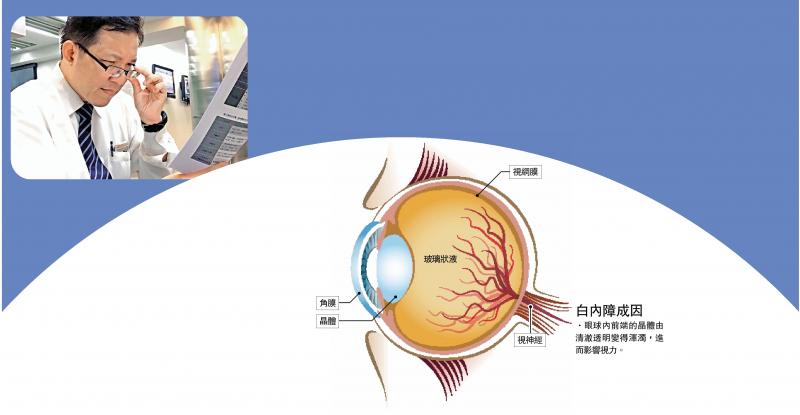 ﻿长者延迟白内障治疗　风险更高\眼科专科医生 陈家杰