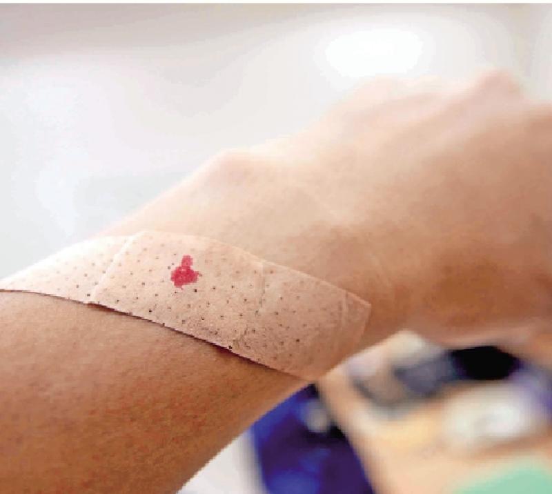 ﻿症状之一/血小板低下 影响凝血功能