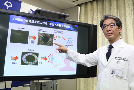 诱导多能干细胞疗法修复患者角膜