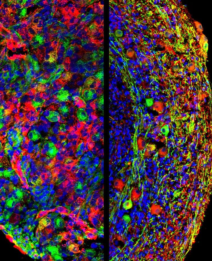我国科研团队成功在体外构建感觉神经复杂体系