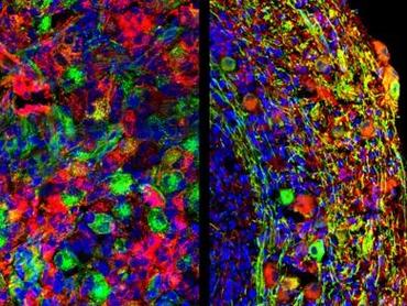 我科研团队在体外构建感觉神经复杂体系