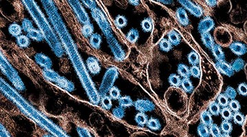 美国录首例人类感染禽流感死亡病例